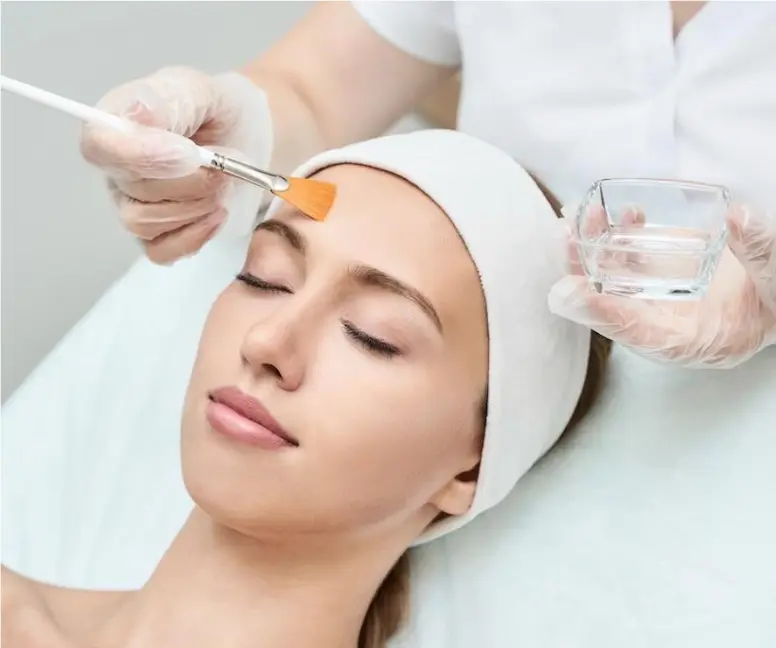 chemical-peel