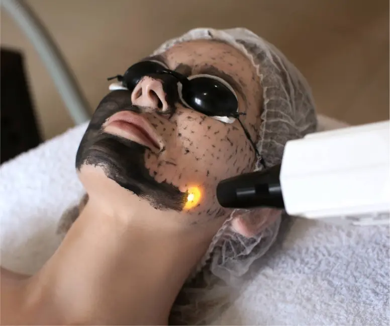 Laser Rejuvenation